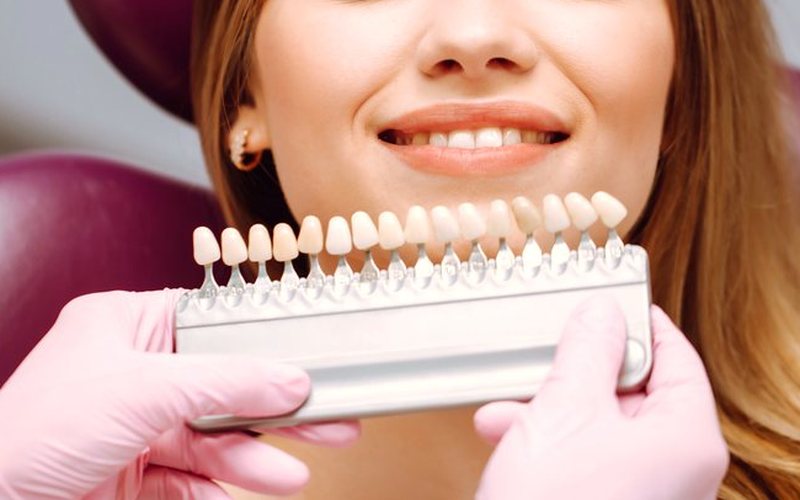 A shade guide held to a patient’s smile during a consult