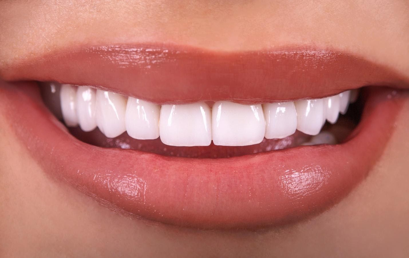 What Do You Know About Dental Veneers Free Nude Porn Photos