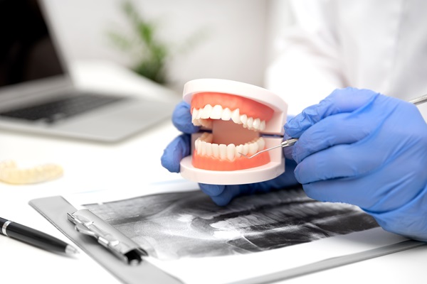 What You Need To Know About Partial Dentures